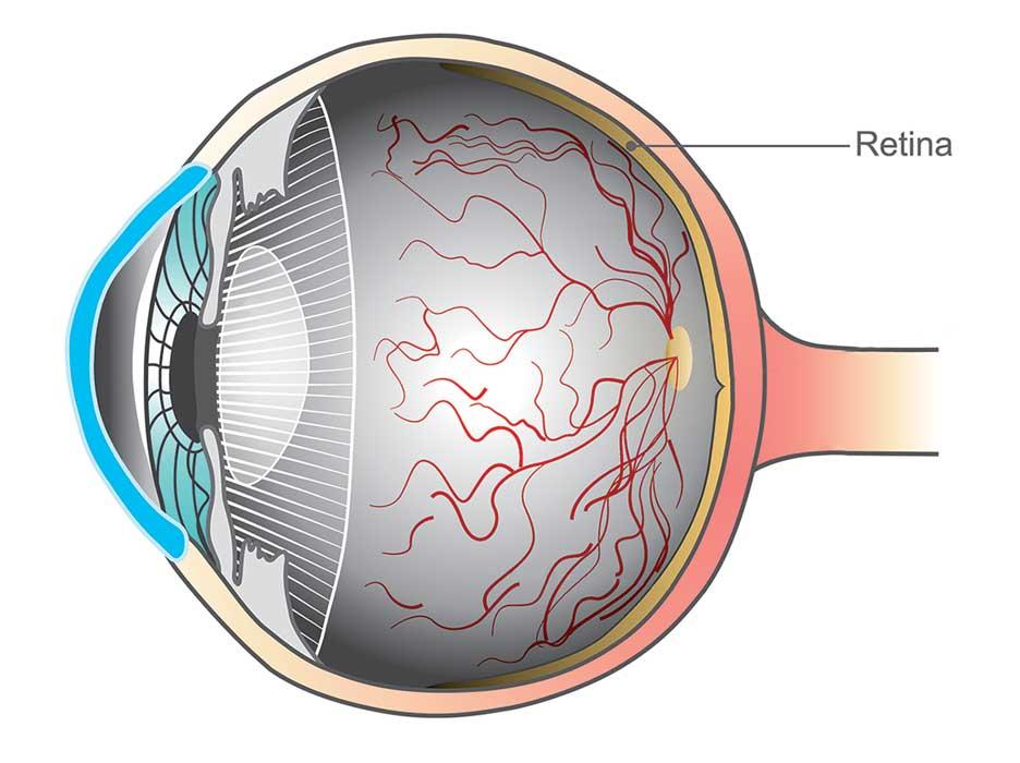 protect-your-eyes