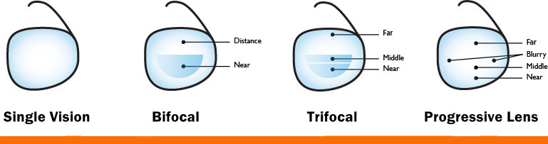 Common Lens Type Abbreviations of Glasses Lens Common Lens Type Abbreviations of Glasses Lens