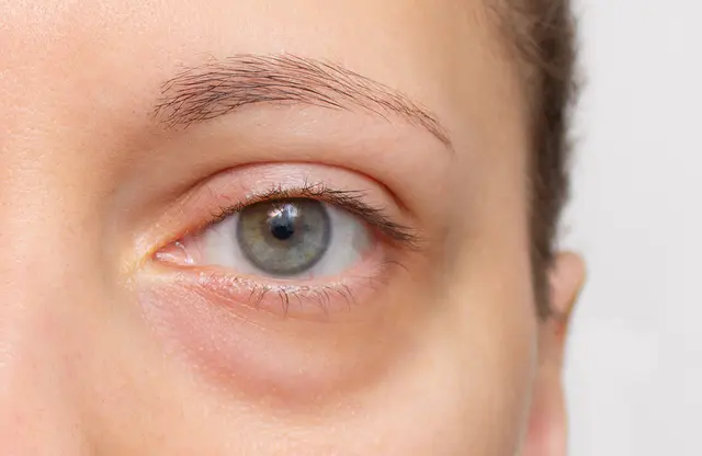 what-causes-gray-eyes-the-science-behind-this-rare-and-stunning-eye-color
